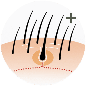 follicle growth plus