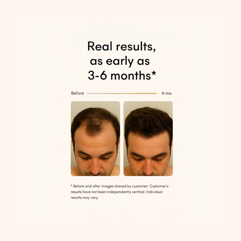 before after product2