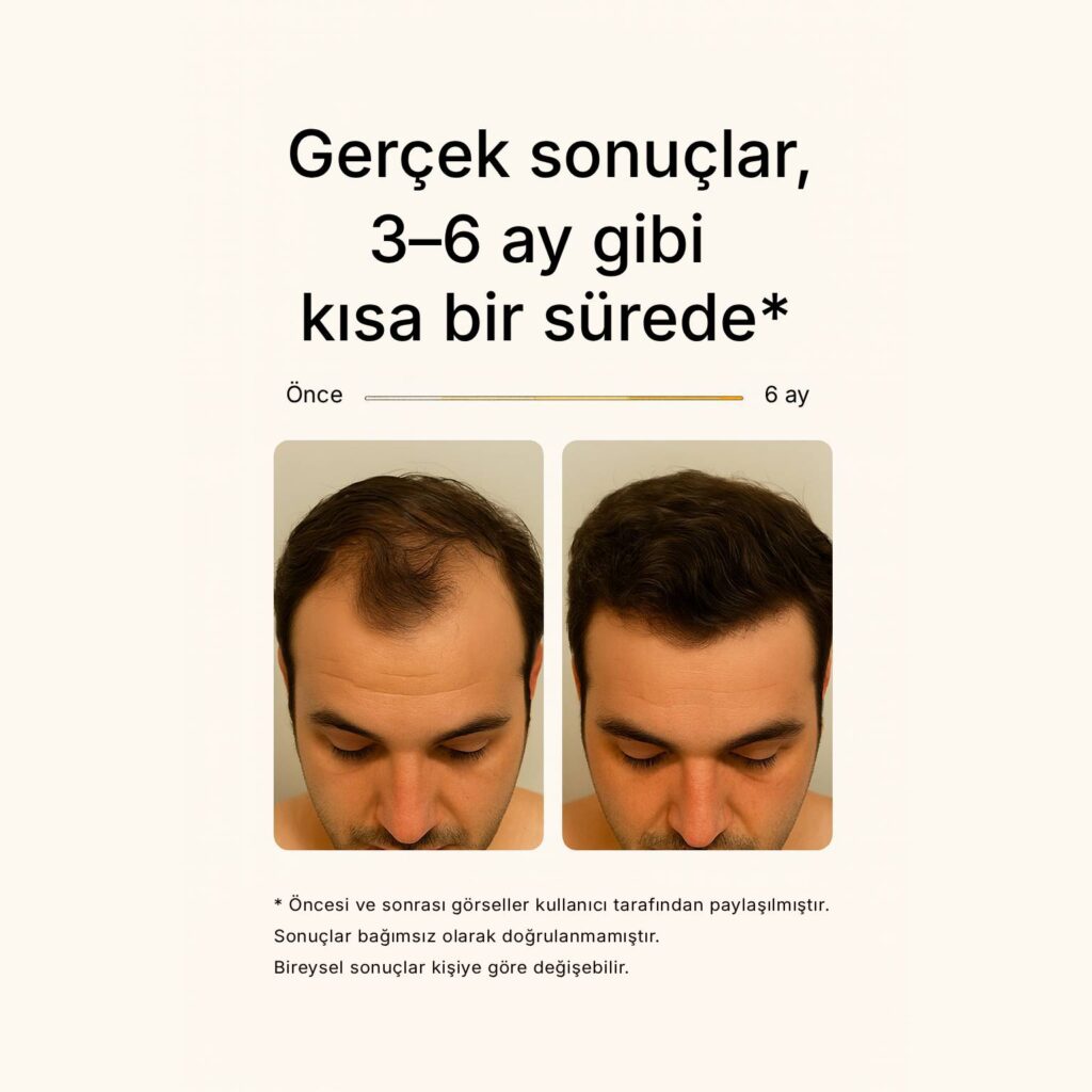 before after product2 turkce